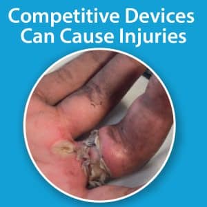 Competitive Ring Removal Devices can cause injuries