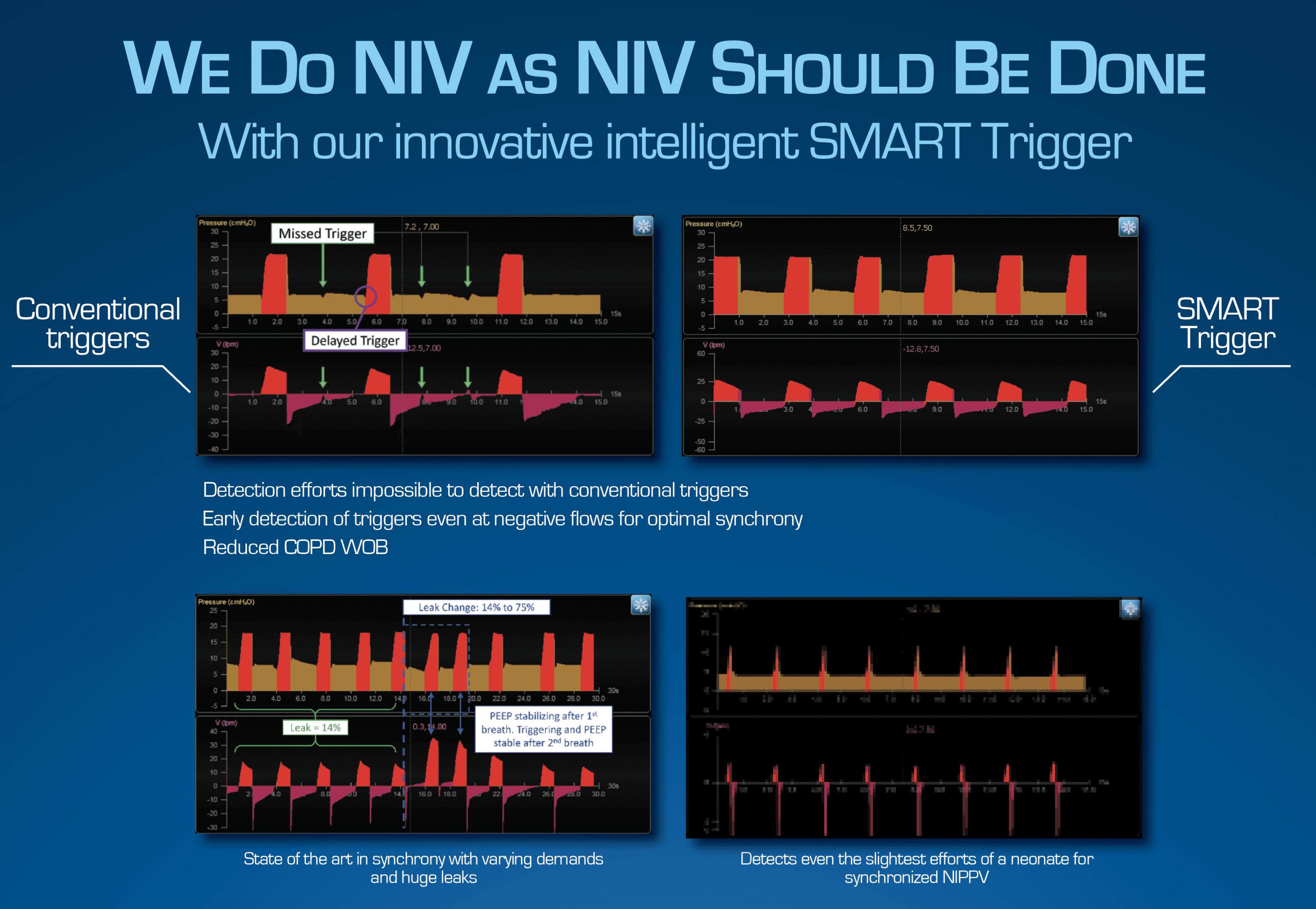 Panther 5N from Origin Medical Devices NIV as it should be